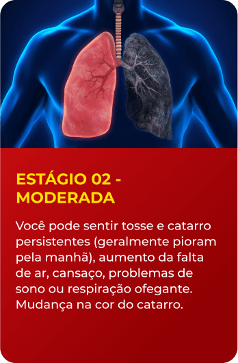 Estágio 2