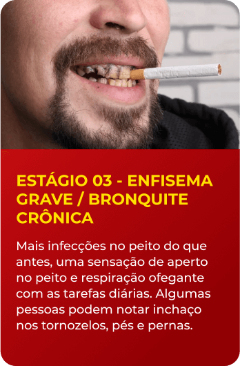 Estágio 3